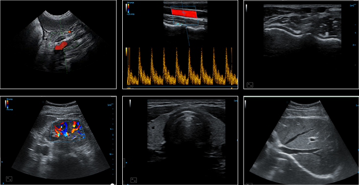 Ultrasound imaging