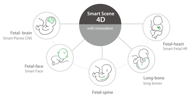 4D ultrasound workflow