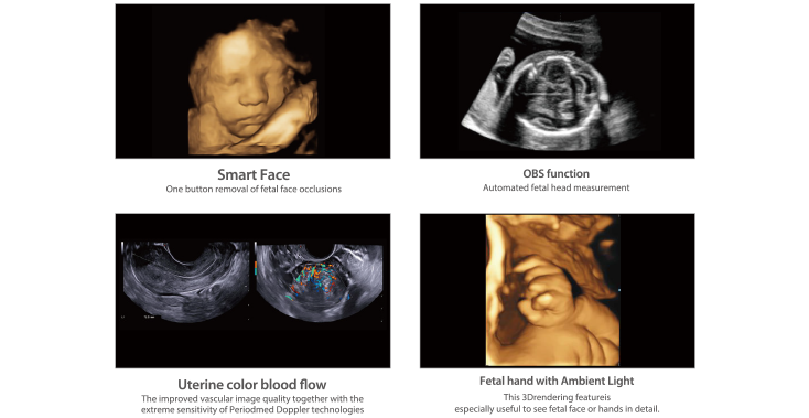 3D and 4D ultrasound imagings