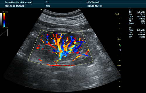 T1 ultrasound imaging