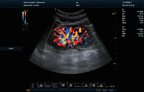 T2 ultrasound imaging 2
