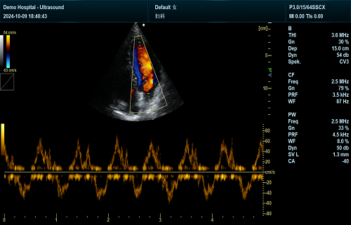 T2 Heart