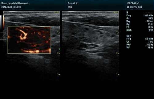 T2 ultrasound imaging
