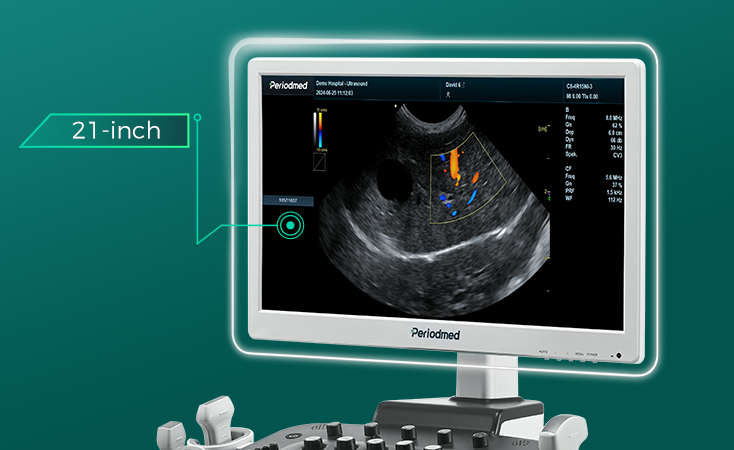 21 inch ultrasound machine