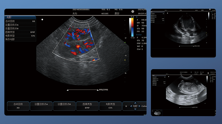 VL151A ultrasound device