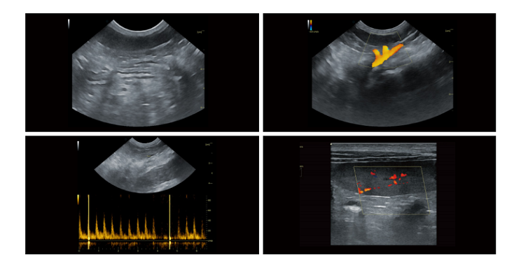 VPIU Series imaging