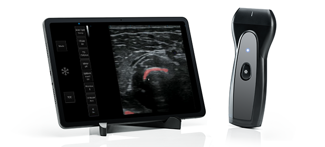 msk ultrasound pau1a
