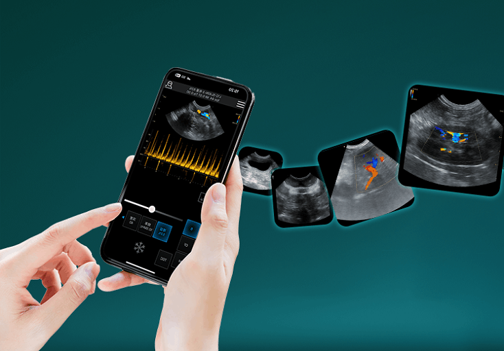 Vet handheld ultrasound